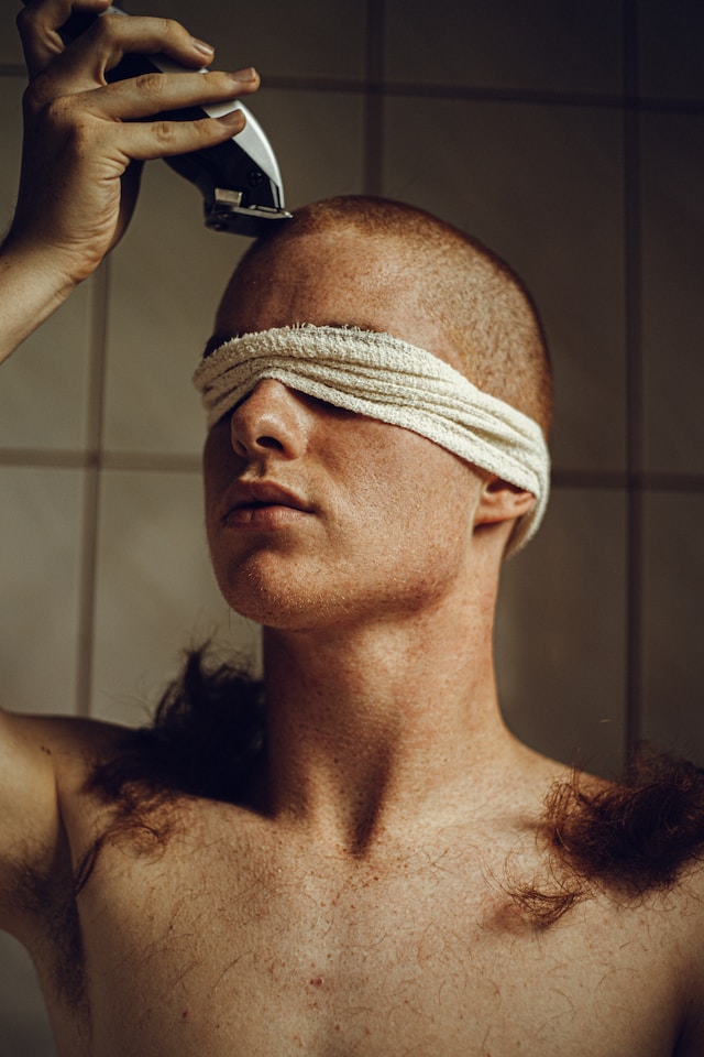 caduta capelli uomo rimedi 2024
